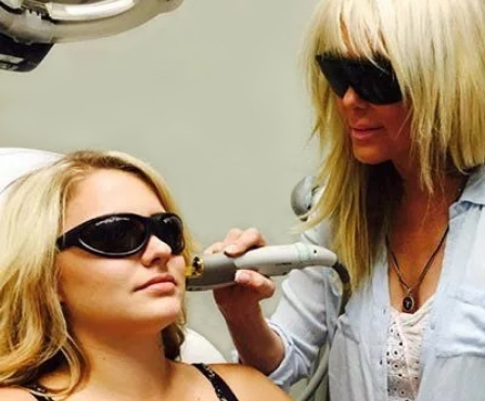 Laser skin treatment