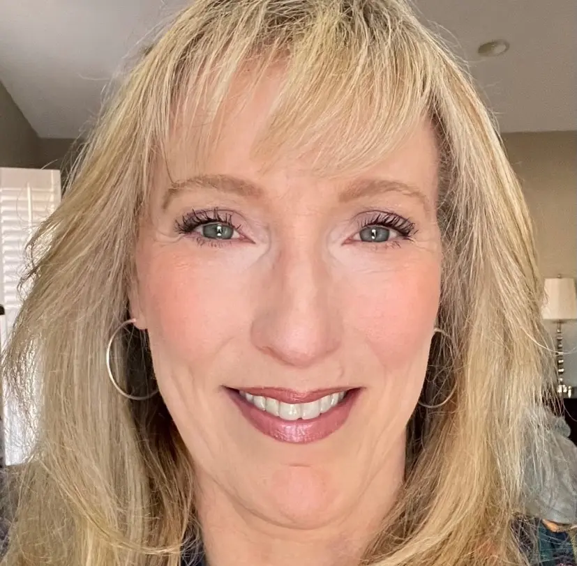 Microneedling results - actual patient