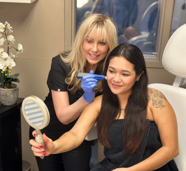 Microneedling patient in San Ramon, CA